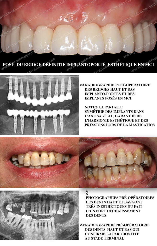 dentier : Tous les messages sur dentier - C'est facile de se moquer